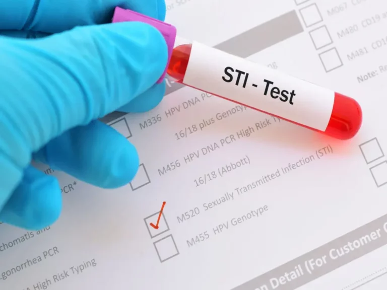 A gloved hand holds a blood sample tube labelled "STI - Test" above a lab form with a ticked box next to "Sexually Transmitted Infection (STI).