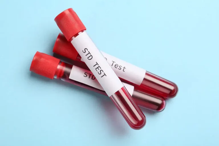 Three blood sample vials labelled "STD TEST" with red caps are placed on a light blue surface.