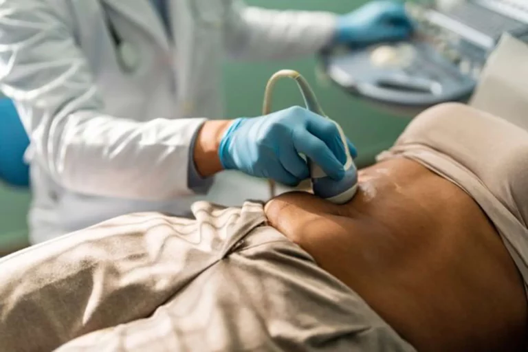 A healthcare professional in gloves performing an abdominal ultrasound scan on a patient lying down.